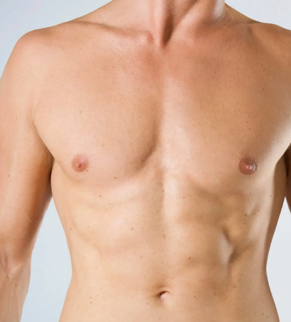 Gynecomastia Consultation Image